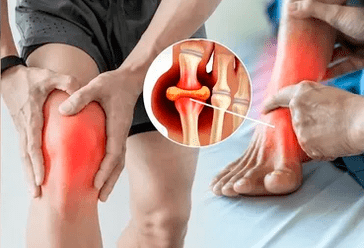 Shema nanašanja Icexin gela na predel kolenskega sklepa in stopala